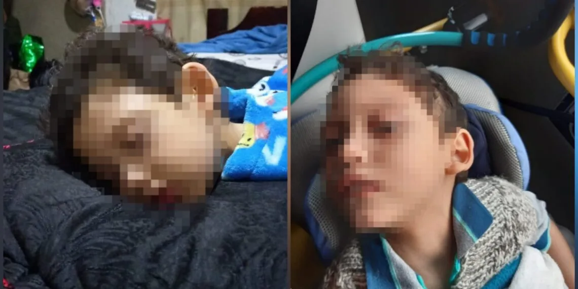 Madre en Socha clama por ayuda para su pequeño hijo. Un accidente le causó daños cerebrales
